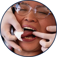 Oral Cancer Screenings