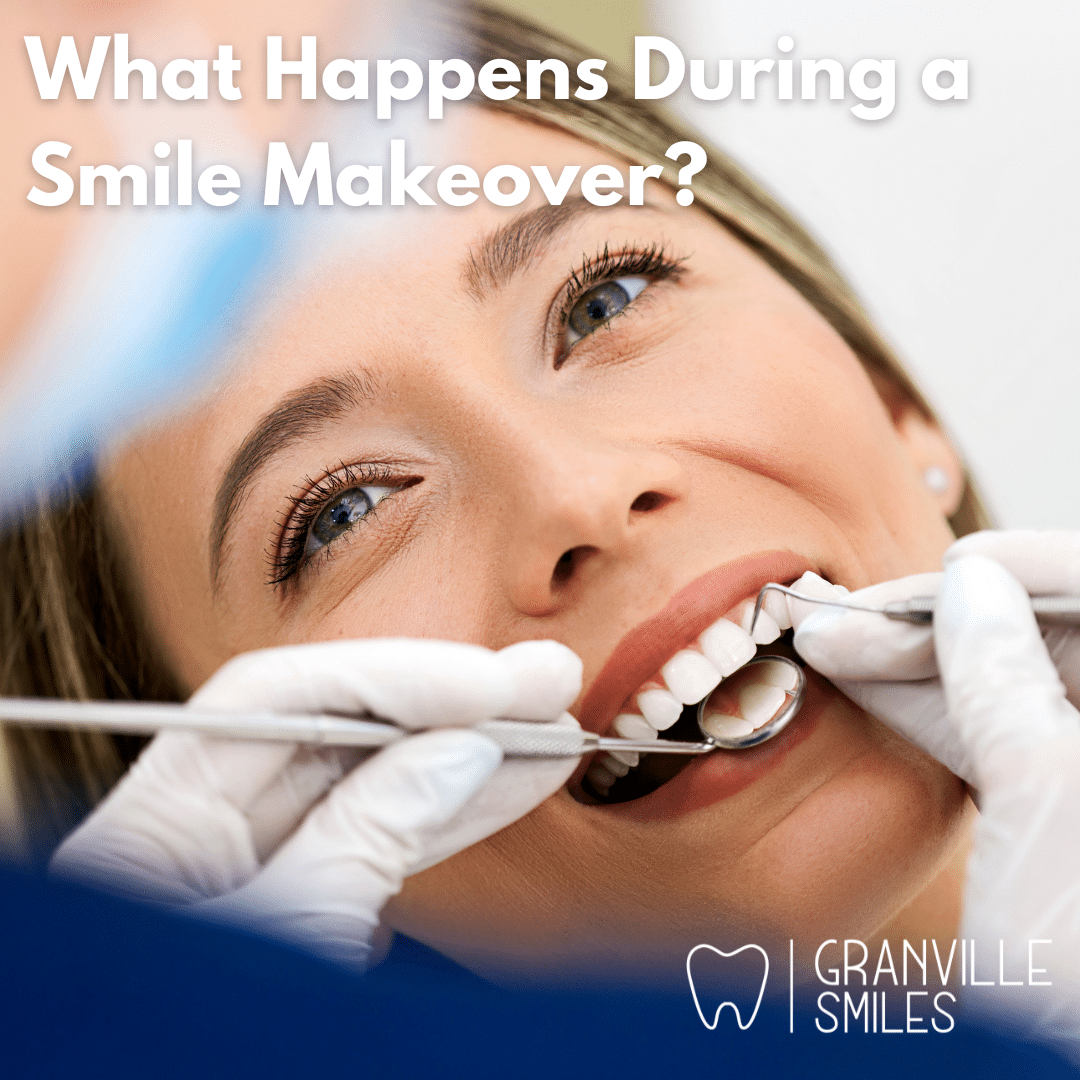 Smile Makeover