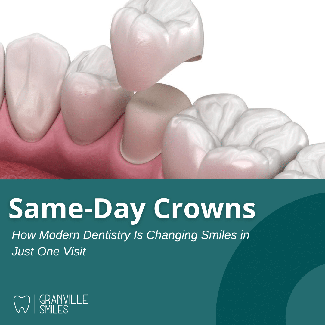 same-day crowns