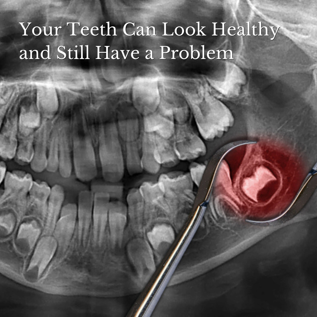teeth can look healthy